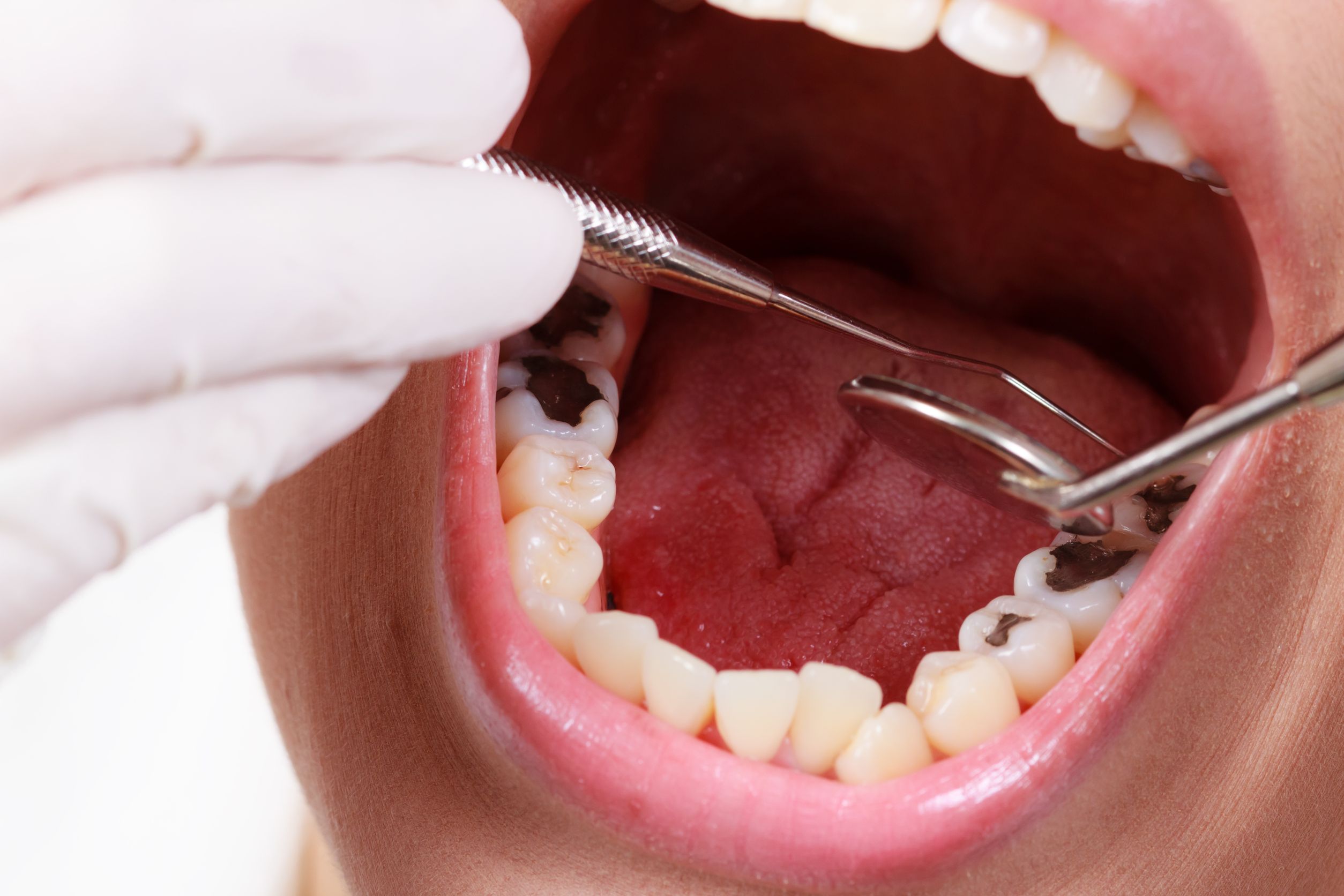 Find The Right General Dentist In Panama City FL