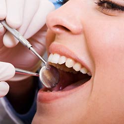Natural Looking Dental Veneers in Lafayette, LA