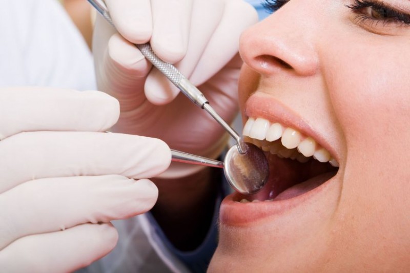 Four Cosmetic Procedures Provided By a Dentist in Anne Arundel