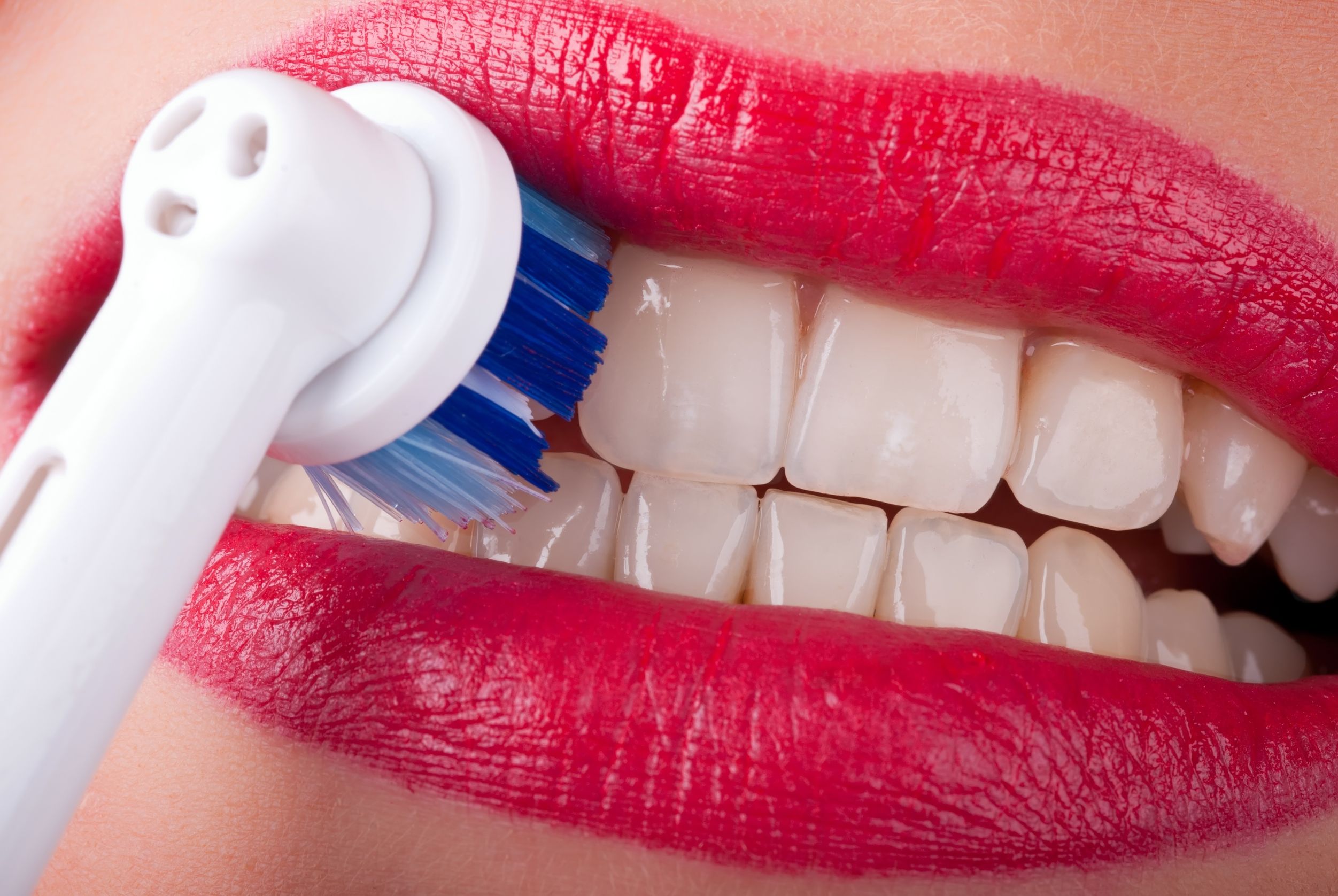 Understanding the Zoom 2 Professional Whitening System in Grand Prairie