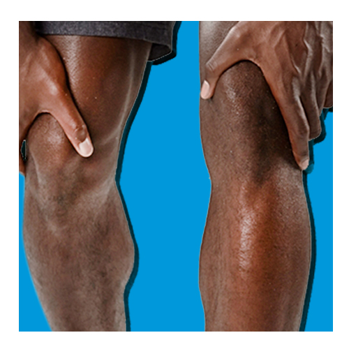 Coping with Knee Pain, At Home, and with Your Healthcare Professional