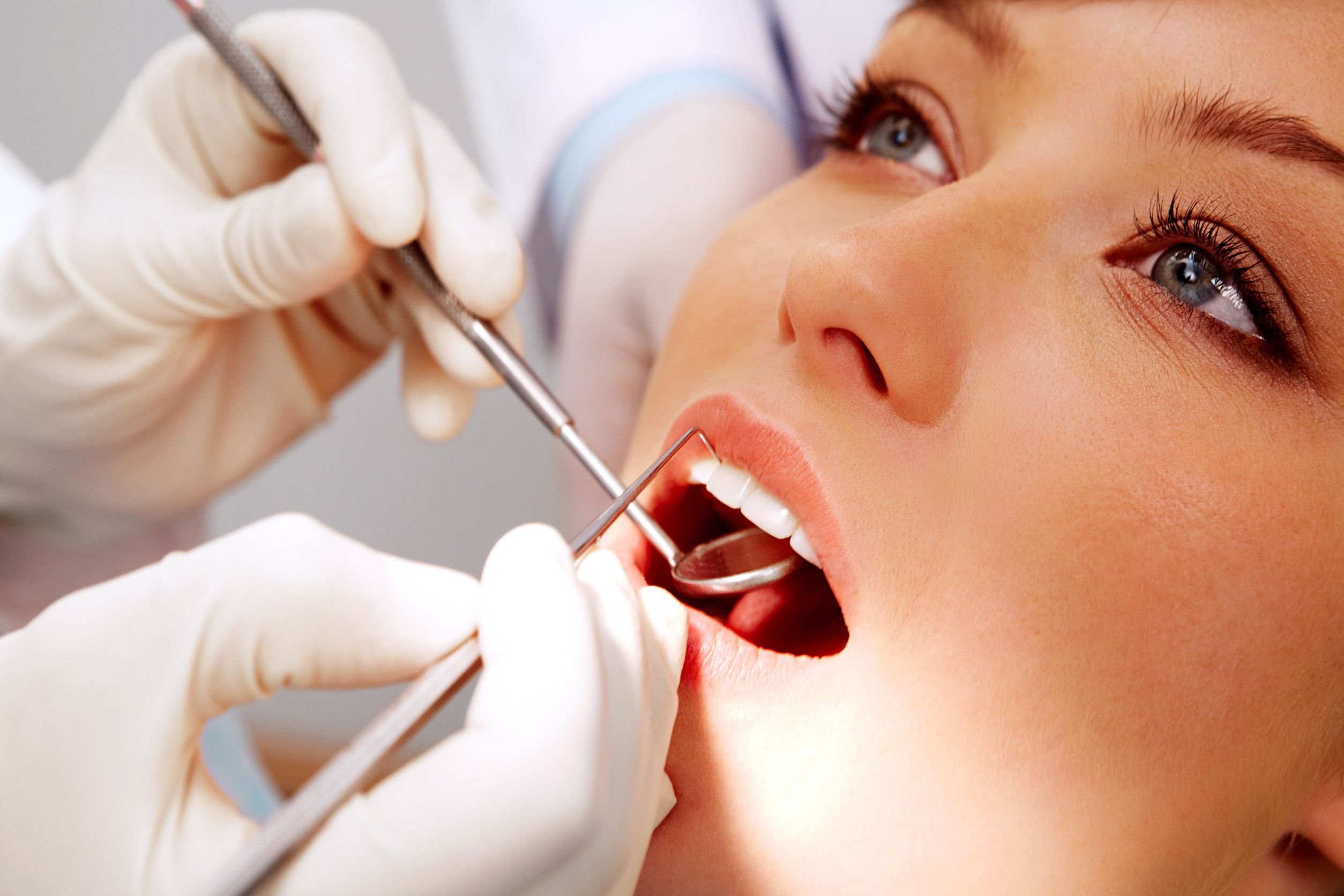 Things You Should Know Before You Consider Getting Dental Veneers