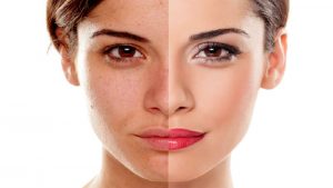 Atlanta Area People do not Need to Worry About Finding Skin Care Solutions
