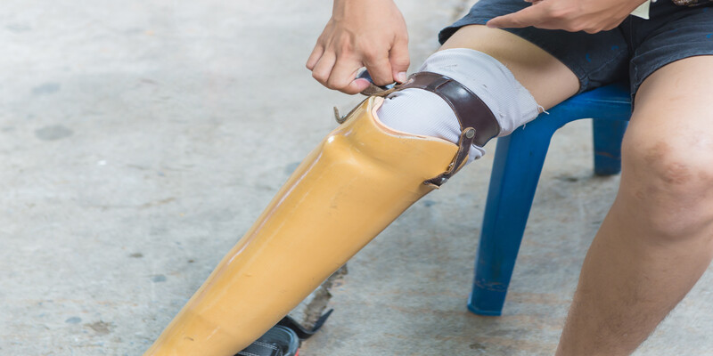 How Custom Foot Orthotics in California Are Revolutionizing Foot Health Care with 3D Printing