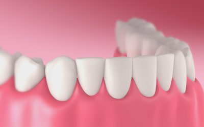 Elevate Your Family’s Dental Wellness with a Trusted and Compassionate Family Dentist in Augusta, GA