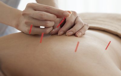 Reclaim your peace with acupuncture for stress in Berkeley, CA
