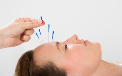 Experience Lasting, Drug-Free Relief: How Acupuncture in Scottsdale, AZ Eases Chronic Pain and Stress