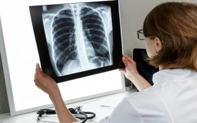 Improve Your Quality of Life at a Leading Sleep Apnea Clinic Hemet CA Residents Choose