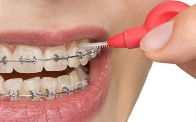 The Benefits Families Gain from Choosing Orthodontics Kennewick for Healthy Smiles